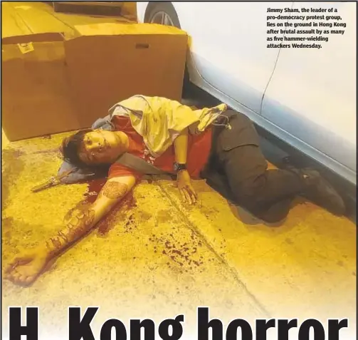  ??  ?? Jimmy Sham, the leader of a pro-democracy protest group, lies on the ground in Hong Kong after brutal assault by as many as five hammer-wielding attackers Wednesday.