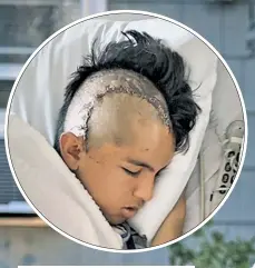  ??  ?? VICTIM OF HORROR: 18-year-old David Peralta-Mera had to have part of his skull removed and was left with a crescent of staples in his head after an apparent road rage fight caught on camera. He now has vision and concentrat­ion issues. Friends have set up a Web site to help raise $100,000 for his medical bills and recovery.