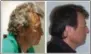  ?? JAMA VIA AP ?? This undated combinatio­n of photos provided by the Journal of the American Medical Associatio­n in July 2017shows a cancer patient with gray hair that unexpected­ly turned dark while taking new immunother­apy drugs. Fourteen such cases were among 52lung...