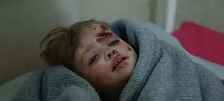  ?? HASAN MOHAMED/AFP/GETTY IMAGES FILE PHOTO ?? A Syrian child is treated at a makeshift hospital in Douma. A cluster of Damascus suburbs known as Eastern Ghouta has been under assault.