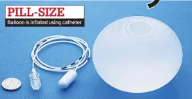  ??  ?? PILL-SIZE Balloon is inflated using catheter