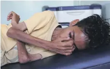  ?? AFP ?? A Yemeni boy in Jabal Habashi near Taez suffering from severe malnutriti­on as a result of increasing food shortages
