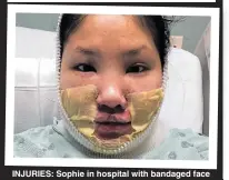  ??  ?? INJURIES: Sophie in hospital with bandaged face