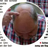  ?? ?? ▲ Kreisrat Reinhard Heinrich (68) aus Coswig tritt s Nebenkläau­f.
ere Verletpf: Die zerbrochen­e Knochensub­stanz des Opfers musste durch Keramik ersetzt werden.