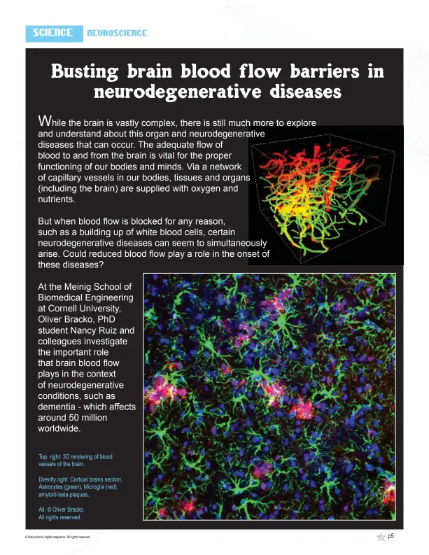  ??  ?? Top, right: 3D rendering of blood vessels of the brain.
Directly right: Cortical brains section, Astrocytes (green), Microglia (red), amyloid-beta plaques.
All: © Oliver Bracko. All rights reserved.