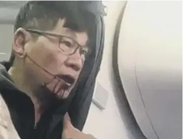  ??  ?? 0 A still from the footage of a doctor being violently removed from a United Airlines flight