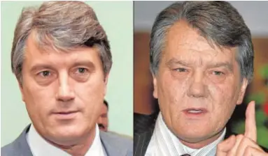  ?? ?? Yúshenko, antes y después del envenenami­ento que sufrió en la campaña electoral de 2004