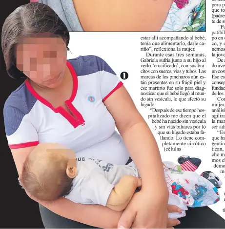  ??  ?? 2. La madre muestra las marcas de los pinchazos que ha recibido la frágil piel del niño.