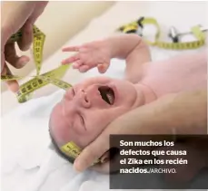  ?? ARCHIVO. ?? Son muchos los defectos que causa el Zika en los recién nacidos./