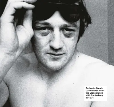  ?? ?? Barbaric: Sandy Carmichael after the Lions match with Canterbury in 1971