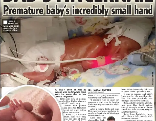  ?? ?? LITTLE MIRACLE: Elsie was given a one-in-four chance of life