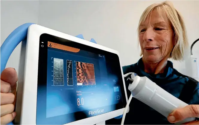  ?? PHOTO: FAIRFAX NZ ?? Hepatitis C clinical nurse specialist Bin Heaphy with the region’s new FibroScan machine.