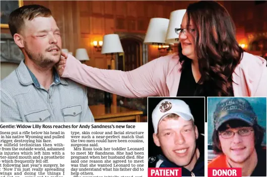  ??  ?? Gentle: Widow Lilly Ross reaches for Andy Sandness’s new face Left: Andy Sandness before his terrible facial injuries Right: Face donor Calen Ross, who died last year PATIENT DONOR