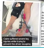  ??  ?? Claire suffered severe leg injuries while trying to prevent the driver escaping