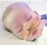  ??  ?? court FiGht Charlie Gard