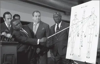  ?? The Associated Press ?? AUTOPSY: Pathologis­t, Dr. Bennet Omalu, second from left, gestures to a diagram showing where police shooting victim Stephon Clark was struck by bullets, during a news conference Friday in Sacramento, Calif. Omalu, who was hired by the family to...