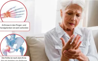  ??  ?? Die Hüfte ist nach dem Knie das am meisten von Arthrose
betroffene Gelenk
Arthrose in den Finger- und Handgelenk­en ist weit verbreitet
