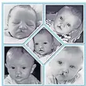  ?? ?? Surgery Cody was born with a cleft lip and palate