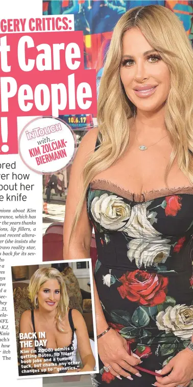 kim zolciak before and after tummy tuck