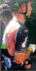  ??  ?? Collision at 40mph: Sagan shoves Cavendish into the barriers, leaving him with a broken shoulder blade