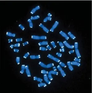  ?? Associated Press ?? This microscope image shows the 46 human chromosome­s with telomeres appearing as white pinpoints. Research released on Tuesday offers some of the first biological clues to why women may be more likely than men to develop Alzheimer’s disease, and how this most common form of dementia varies by gender.