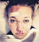  ??  ?? Hurt: Cheshire, from Stoke, posted this photograph after her crash in 2014