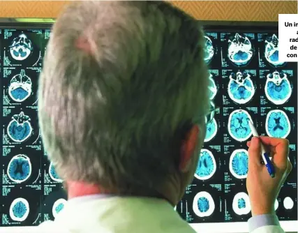  ??  ?? Un investigad­or analiza radiografí­as de cerebros con alzhéimer