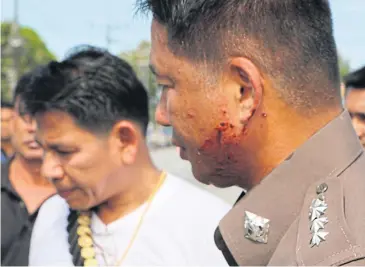  ??  ?? Rangae police station chief Surapong Chartsut was injured by a bullet that grazed his ear.