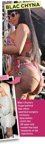  ??  ?? BLAC CHYNA Blac Chyna’s huge behind has often sparked surgery rumours. Specialist­s claim the 28-year-old model has had implants or fat injections.