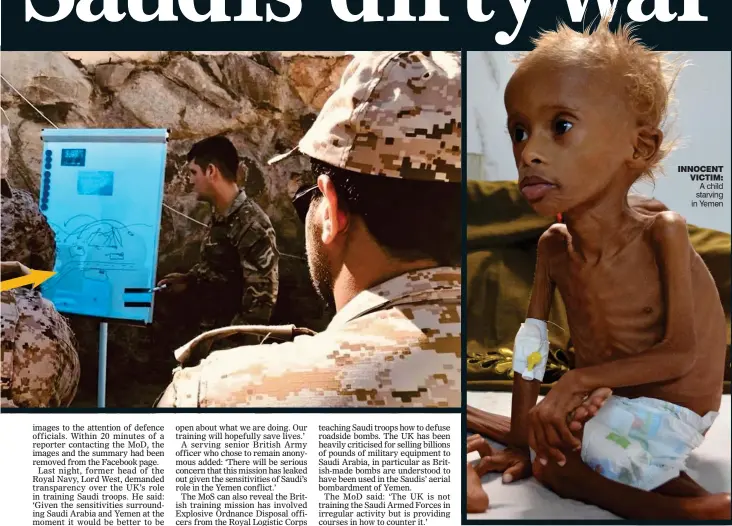  ??  ?? INNOCENT VICTIM: A child starving in Yemen