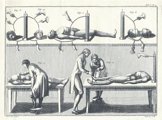  ?? Gentileza bn ?? Imagen que pertenece a los experiment­os con electricid­ad sobre seres humanos de Giovanni Aldini, circa 1800