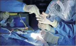  ??  ?? Surgeons say that shared viewing makes 3-D surgery an ideal teaching tool. Doctors also say the device is much smaller and less cumbersome than standard surgical microscope­s and provides better light. Two surgeons on opposite sides of the table can work together easily.