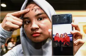  ??  ?? Painful reminder: Nurul Fatin Nabila showing her injury and a picture of Siti Nur Iesmawida (centre) who was also her colleague at KLIA2 in Sepang.
