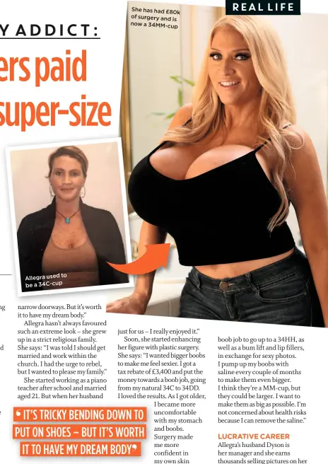 Strangers paid for my super-size boobs' - PressReader