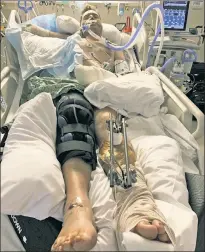  ??  ?? NIGHTMARE: Carter Viss (in happier times, far left) lies in a Florida hospital Saturday after being run over by a boat off the shore of Palm Beach on Thursday.