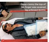  ??  ?? Depp claims the top of his finger was severed
by a thrown bottle