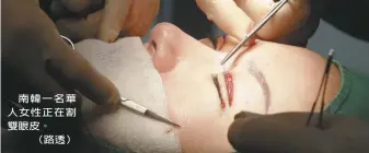  ??  ?? 南韓一名華人女性正在­割雙眼皮。（路透）