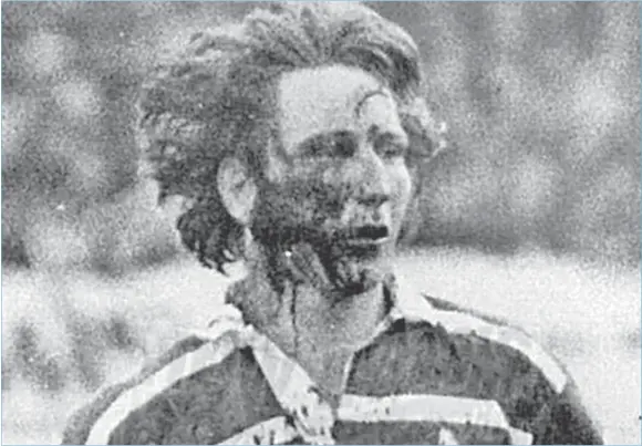  ?? Picture: SUPPLIED ?? A blood-soaked JPR Williams leaves the field for treatment after being stamped on while playing for Bridgend against New Zealand in 1978.