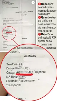  ??  ?? 1Bebé apresenta diversas marcas de agressão na cara 2Quando despiu o filho em casa, a queixosa viu mais hematomas no corpo 3Relatório do hospital à PSP aponta como causa uma
agressão