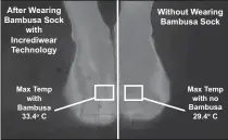  ??  ?? After Wearing Bambusa Sock
with Incrediwea­r Technology Max Temp
with Bambusa
33.4o C Without Wearing Bambusa Sock Max Temp
with no Bambusa
29.4o C The infrared anions, generated by the charcoal bamboo increase blood flow and deliver oxygen to...