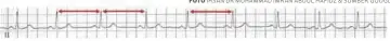  ?? FOTO IHSAN DR MUHAMMAD IMRAN ABDUL HAFIDZ & SUMBER GOOGLE ?? ECG nadi individu normal.