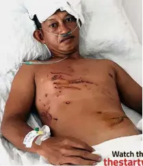  ??  ?? Back from the
brink: Nursahim recovering at the Queen Elizabeth Hospital in Kota Kinabalu.