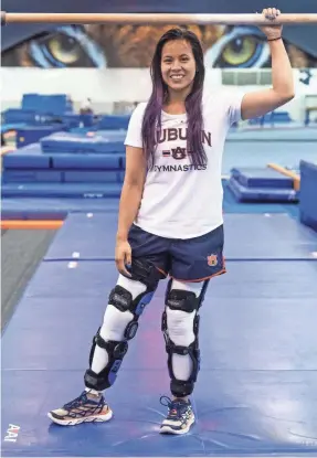  ?? MICKEY WELSH/MONTGOMERY ADVERTISER ?? Auburn gymnast Sam Cerio dislocated both of her knees and ruptured multiple ligaments in her legs during an NCAA regional semifinal meet in April. Days after receiving her diploma, she was at the women’s gymnastics practice facility on campus.
