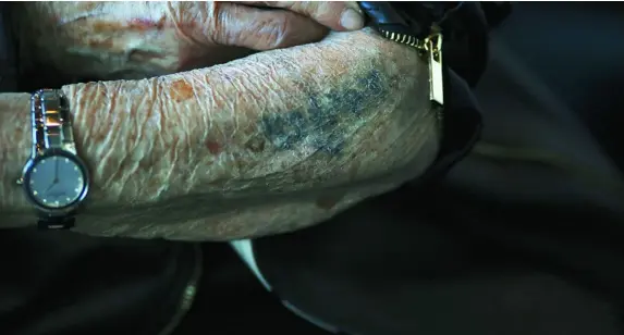  ?? AP ?? El brazo de Bronia Brandman, supervivie­nte del Holocausto, marcado por los tatuajes distintivo­s de los nazis