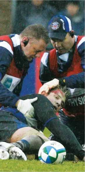  ?? PICTURE: Getty Images ?? KO: Michael Lipman is treated after his heavy clash against Toulouse