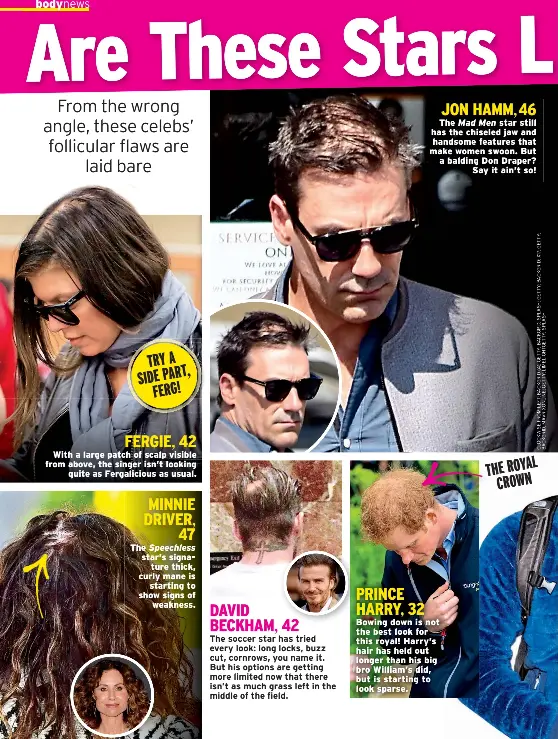 Are These Stars Losing Their Hair?! - PressReader