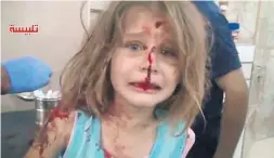  ??  ?? La nena siria. Símbolo tremendo del daño de la guerra.