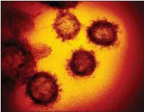  ?? NIAID-RML — VIA TRIBUNE NEWS SERVICE ?? An image from an electron microscope shows SARSCoV-2, the virus that causes COVID-19. A study says 319,000 people could have been saved from deaths caused by COVID-19if they had gotten vaccinated.