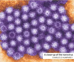  ?? CHARLES D HUMPHREY ?? A close-up of the norovirus