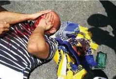  ??  ?? SEORANG lelaki yang cedera selepas polis Israel menggunaka­n gas pemedih mata dan menembak peluru hidup untuk menyuraika­n tunjuk perasaan penduduk Palestin. - Agensi
